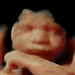 3D scan of a babies face