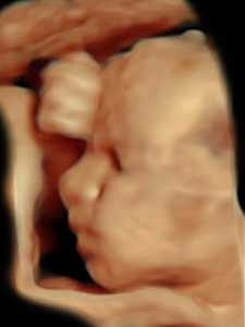 3D scan of a babies face