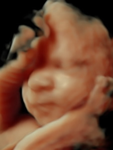 3D scan of a babies face