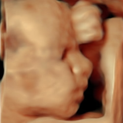 scan of babies face
